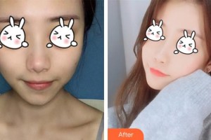 南充潤禾皮膚病專科醫(yī)院邱坤整形價格表附光子嫩膚案例展示