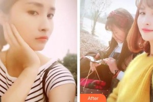 南充美佳口腔診所王永文整形價格表附牙齒隱形矯正案例展示