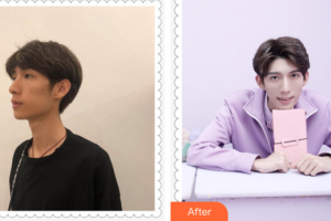 深圳南州口腔門診部彭仁章整形價格表附牙齒矯正案例展示