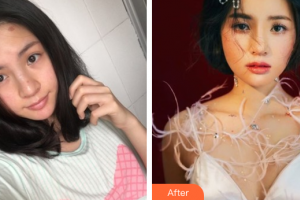 深圳纖韻醫(yī)療美容門診部鐘學行整形價格表附鼻部手術(shù)案例展示