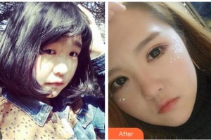 宜賓愛(ài)爾優(yōu)視眼科醫(yī)院潘麗梅整形價(jià)格表附埋線雙眼皮案例展示