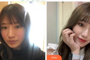 宜賓華膚皮膚病醫(yī)院胡朝雄整形價(jià)格表附光子嫩膚案例展示