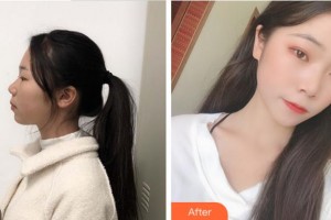 宜賓華膚皮膚病醫(yī)院何學(xué)敏整形價格表附光子嫩膚案例展示