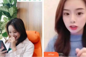 達(dá)州華美口腔醫(yī)院張雪霏整形價格表附牙齒隱形矯正案例展示