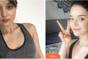 武警湖南總隊(duì)醫(yī)院整形美容中心孔偉立整形價(jià)格表附激光美膚激光案例展示