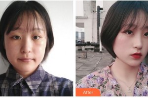 湖南博雅眼科醫(yī)院王鈾整形價(jià)格表附眼部整形案例展示