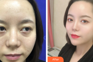 珠?？泼泪t(yī)療美容醫(yī)院李金瓊整形價格表附私人訂制童顏術(shù)基礎(chǔ)版案例展示