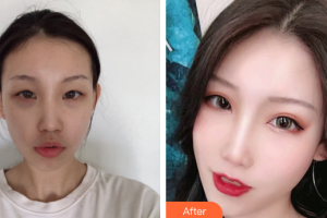 珠?？泼泪t(yī)療美容醫(yī)院金俊浩整形價格表附眼部整形案例展示