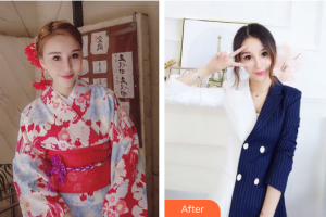 珠海惠愛醫(yī)院整形美容科于燕整形價(jià)格表附紅藍(lán)光去痘案例展示