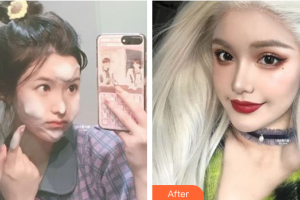 珠海陽(yáng)光醫(yī)院整形美容中心高廣華整形價(jià)格表附膨體肋軟骨隆鼻案例展示