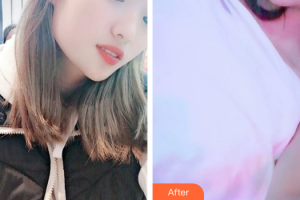 珠海拜博口腔醫(yī)院徐連來(lái)整形價(jià)格表附超聲波洗牙案例展示