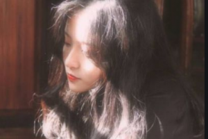 南昌大學(xué)第一附屬醫(yī)院整形美容科李文芳整形價(jià)格表附光子嫩膚案例展示