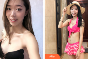 佛山壹加壹瑪麗婭整形美容醫(yī)院郝冬整形價(jià)格表附自體脂肪隆胸案例展示