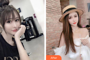 佛山黛顏人醫(yī)療美容門(mén)診部黃吉波整形價(jià)格表附鼻部手術(shù)案例展示