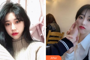 佛山廣美醫(yī)療美容門(mén)診部陳佳整形價(jià)格表附鼻翼縮小案例展示