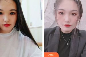 佛山美嘉美醫(yī)療美容門診部徐麗心整形價格表附白瓷娃娃案例展示