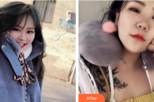 湛江市第一中醫(yī)院整形美容中心趙璽耀整形價(jià)格表附水氧活膚案例展示