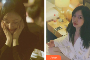 梅州方圓醫(yī)療美容門診部方媛整形價格表附激光美膚激光案例展示