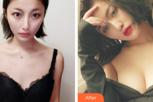 東莞百佳瑪麗亞婦產(chǎn)醫(yī)院李昌煥整形價(jià)格表附假體隆胸案例展示