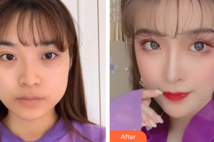 東莞瑞芙臣醫(yī)療美容門診部樸埈奎整形價(jià)格表附下頜角磨骨案例展示