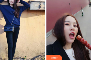 東莞依謀醫(yī)療美容醫(yī)院白大純整形價(jià)格表附自體脂肪全臉填充案例展示