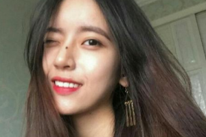 武漢科技大學(xué)附屬天佑醫(yī)院整形美容科陳芳整形價格表附光子嫩膚案例展示