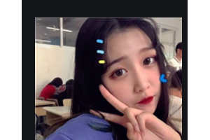 武漢伽美醫(yī)療美容醫(yī)院林孟羲整形價(jià)格表附耳軟骨復(fù)合隆鼻案例展示