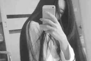 廣東藥學(xué)院附屬第一醫(yī)院激光整形美容外科惠俐整形價格表附紅藍(lán)光祛痘案例展示