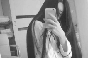 廣東省人民醫(yī)院燒傷整形科瀛整形價格表附激光祛斑案例展示