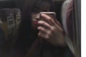 武警廣東總隊醫(yī)院整形美容中心貝維君整形價格表附激光祛斑案例展示