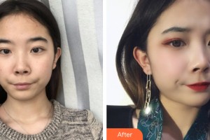 河南省整形美容研究中心徐公良整形價格表附皮膚美容案例展示