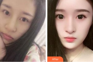 河南省軍區(qū)醫(yī)院激光美容中心張黎整形價格表附皮膚美容案例展示