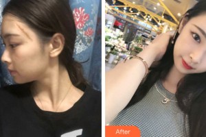 海南整形美容醫(yī)院馬文熙教授，整形價(jià)格表附皮膚美容案例展示