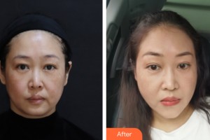 海南夢(mèng)妮幻整形?？崎T診部何濤整形價(jià)格表附皮膚美容案例展示