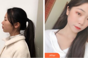 海南省人民醫(yī)院激光美容整形科劉韻整形價(jià)格表附皮膚美容案例展示