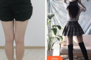 云南華美美萊美容醫(yī)院黃麗瓊整形價(jià)格表附吸脂案例展示