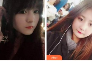 云南德普口腔醫(yī)院全允植整形價(jià)格表附根管調(diào)節(jié)案例展示