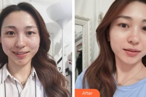 海南省皮膚病醫(yī)院激光整形美容中心焦仕程整形價(jià)格表附皮膚美容案例展示