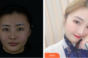 海南瑞韓醫(yī)學(xué)美容醫(yī)院馬愛(ài)紅整形價(jià)格表附皮膚美容案例展示