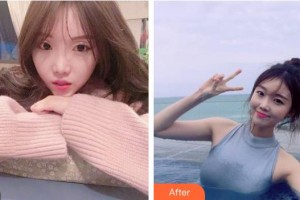 昆明天倫婦產醫(yī)院醫(yī)學整形美容中心米娜主診醫(yī)師整形價格表附鼻部綜合案例展示