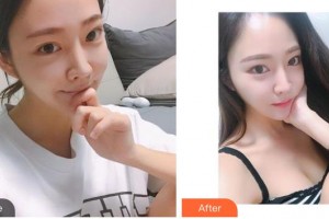 整形醫(yī)院王強(qiáng)整形價(jià)格表附光子嫩膚案例展示