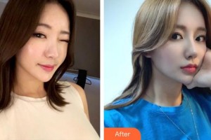 昆明前衛(wèi)美眼整形專科診所馮曉明整形價格表附鼻部綜合案例展示