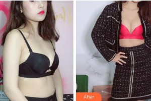 昆明達(dá)美醫(yī)療美容診所王瀟健整形價(jià)格表附假體隆胸案例展示