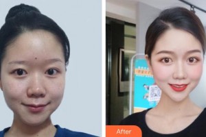 昆明皮膚病?？漆t(yī)院黃文標(biāo)整形價(jià)格表附激光祛斑案例展示