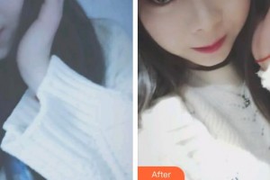 昆明皮膚病?？漆t(yī)院王正文整形價(jià)格表附眼部綜合案例展示