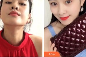 昆明愛(ài)爾眼科醫(yī)院董雪蓮住院醫(yī)師整形價(jià)格表附定點(diǎn)雙眼皮案例展示