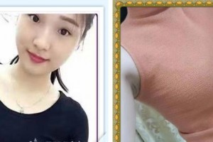 揚(yáng)州施爾美醫(yī)療美容醫(yī)院冷永成整形價(jià)格表附自體脂肪隆胸案例展示