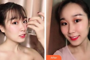 儲(chǔ)志強(qiáng)整形價(jià)格表附牙齒隱形矯正案例展示