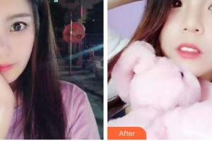 昆明醫(yī)科大學附屬口腔醫(yī)院億大口腔門診部華文整形價格表附牙齒隱形矯正案例展示