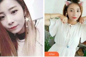 昆明醫(yī)科大學(xué)附屬口腔醫(yī)院億大口腔門診部羅光明整形價(jià)格表附牙齒隱形矯正案例展示